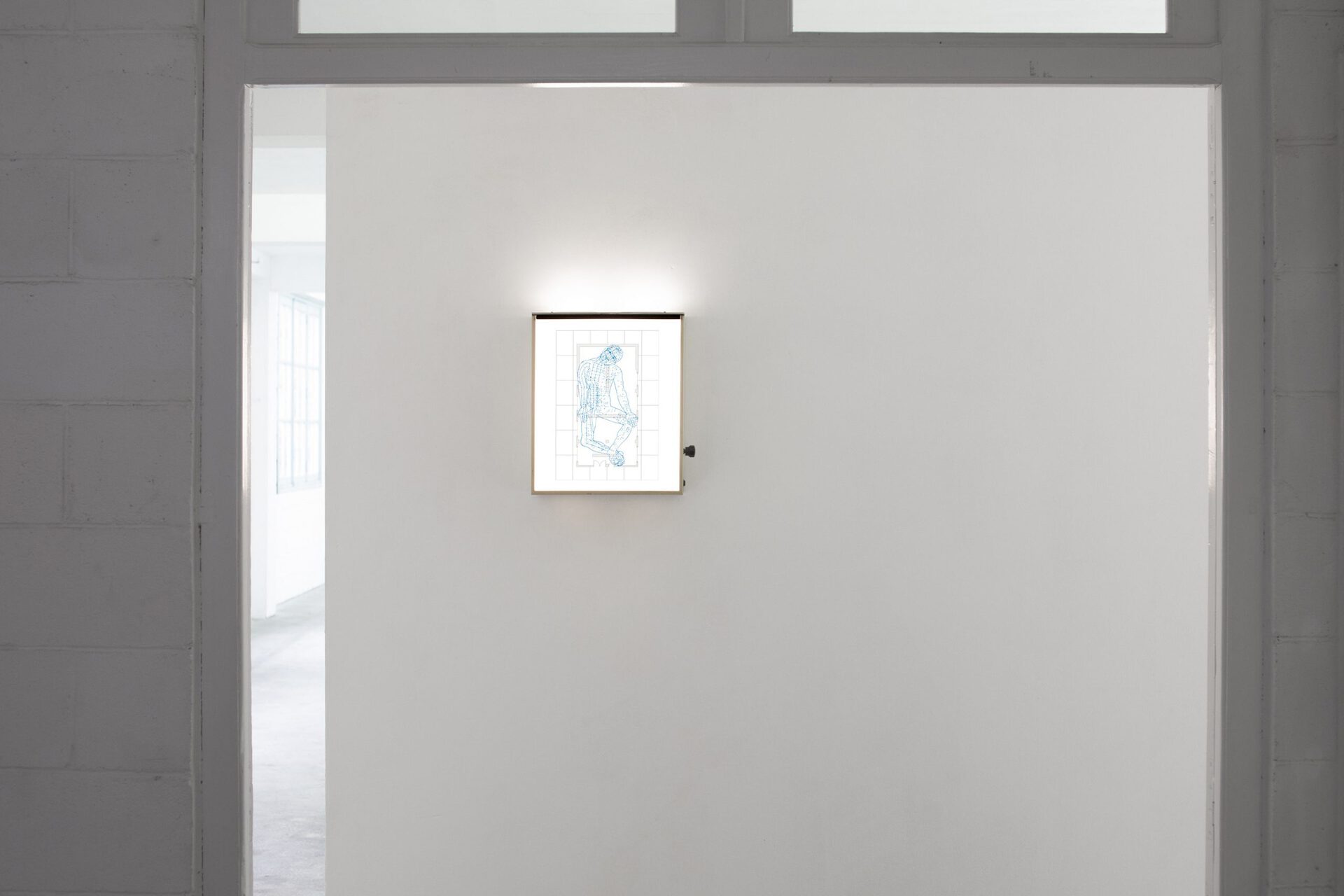 Maxime Bichon, Négatoscope, 2021, X-ray viewing box, printed plexiglass, 41x45,5x13,5cm