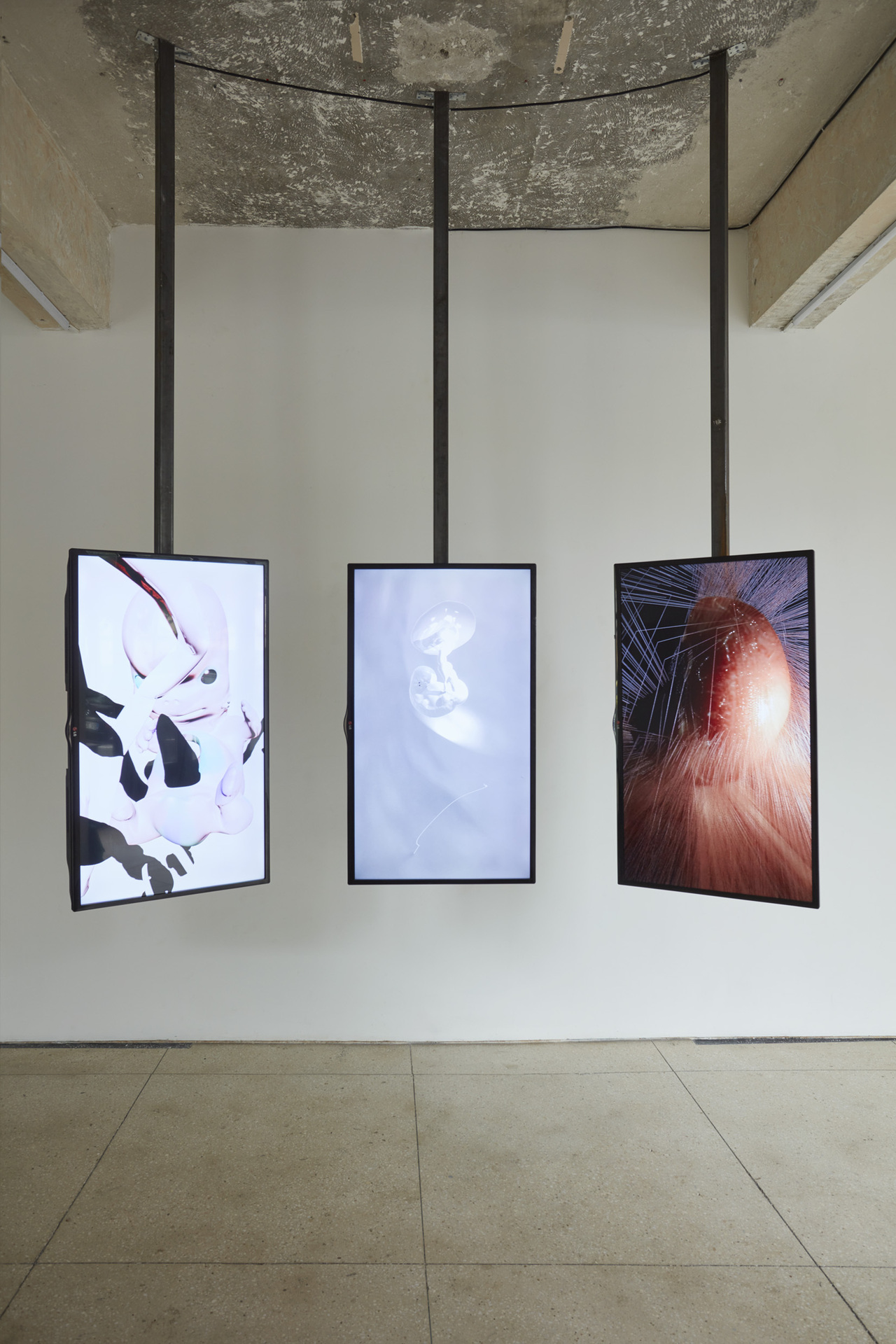 Tzusoo, Schrödinger's Baby, 2019/2020, 3-channels video installation, loop week 04 00:05:25 week 08 00:04:11 week 16 00:04:19