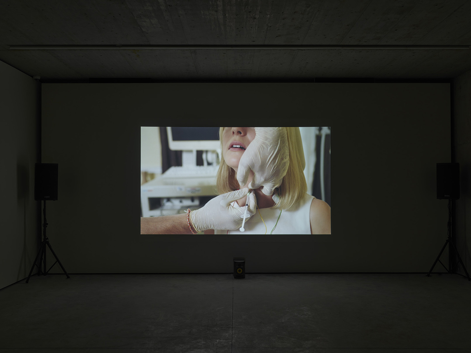 Marianna Simnett, The Needle and the Larynx, 2016, Digital HD video with surround sound