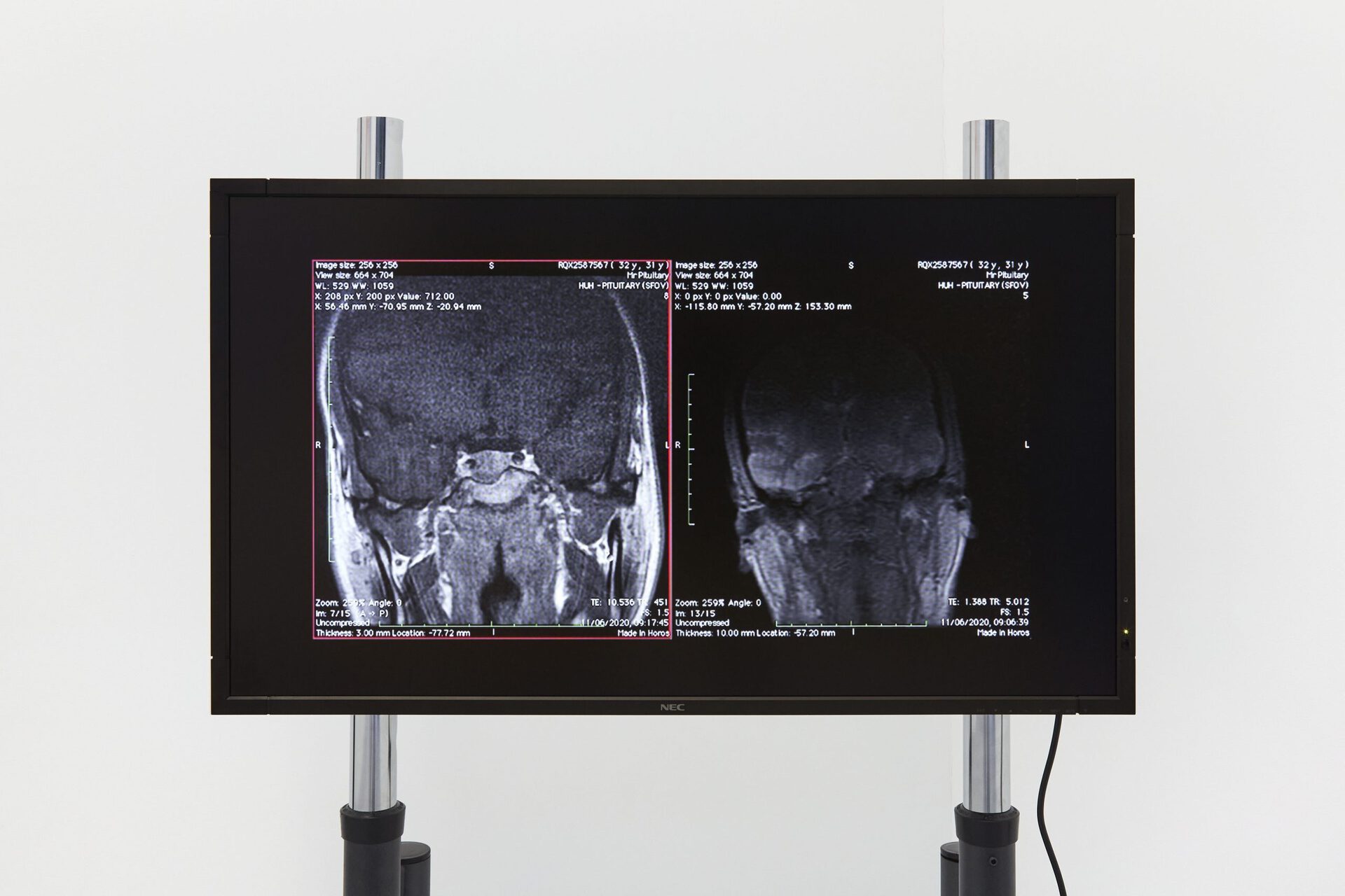 Robert Orr, Localizers I & II, 2022, HD video (TRT: 2:30), HD monitor, Unicol trolley, 160 x 90 x 70cm approx.