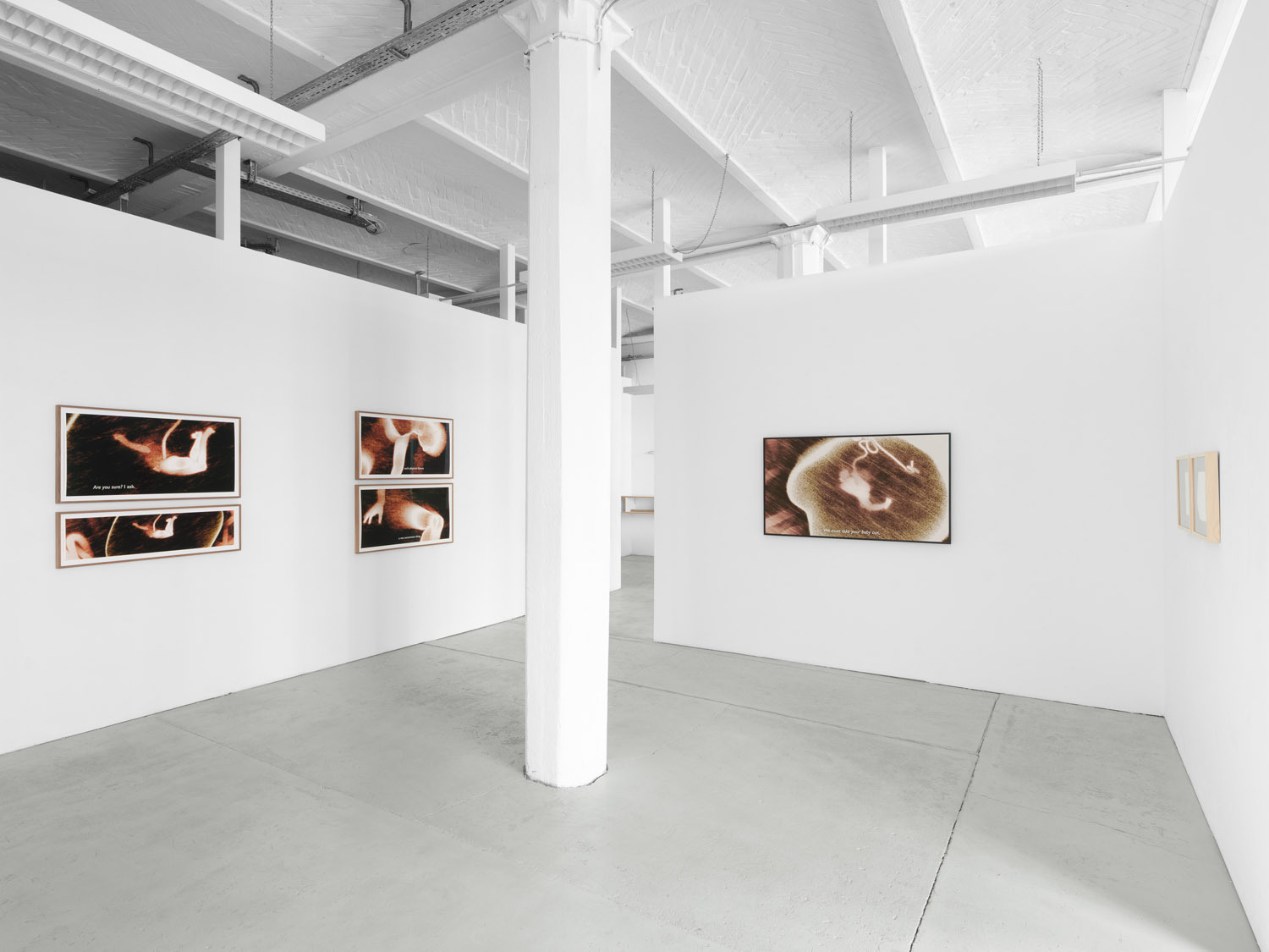 Ana Maria Caballero, Echo Graph, 2024, exhibition view