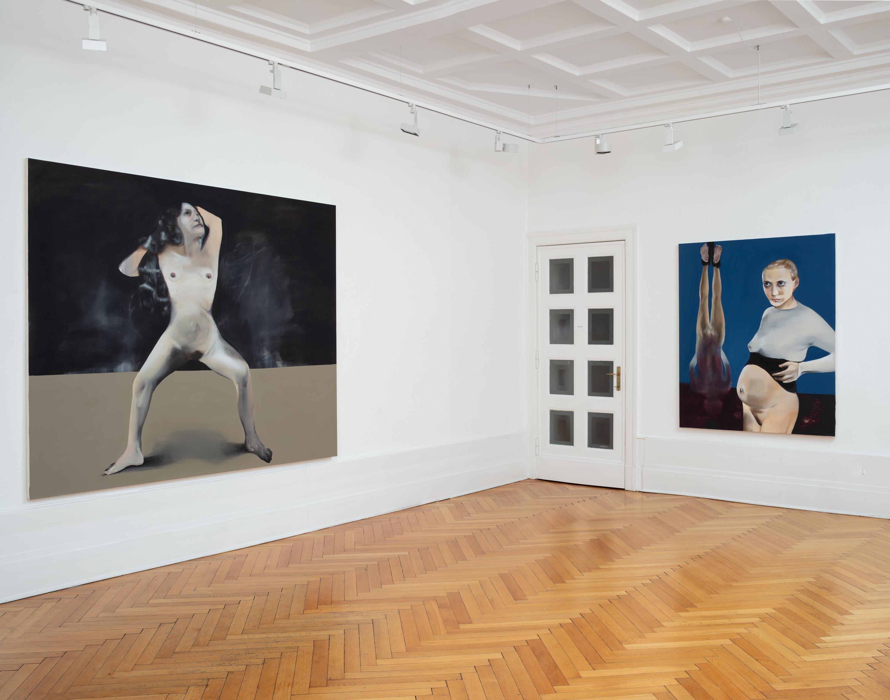 Installation view: Elsa Rouy â I Pictured Skin at GNYP Gallery Berlin, 2025. Courtesy of the Artist & GNYP Gallery / Credits: Ludger Paffrath / Copyright: The Artist