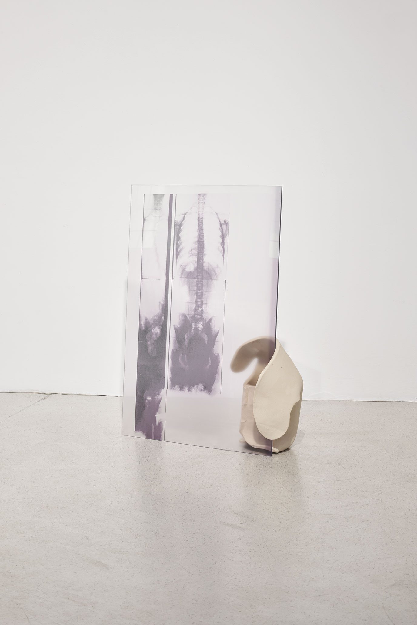 Korrektur 1 (2026), scan, digitally edited using Adobe's Healing Brush tool, ceramic